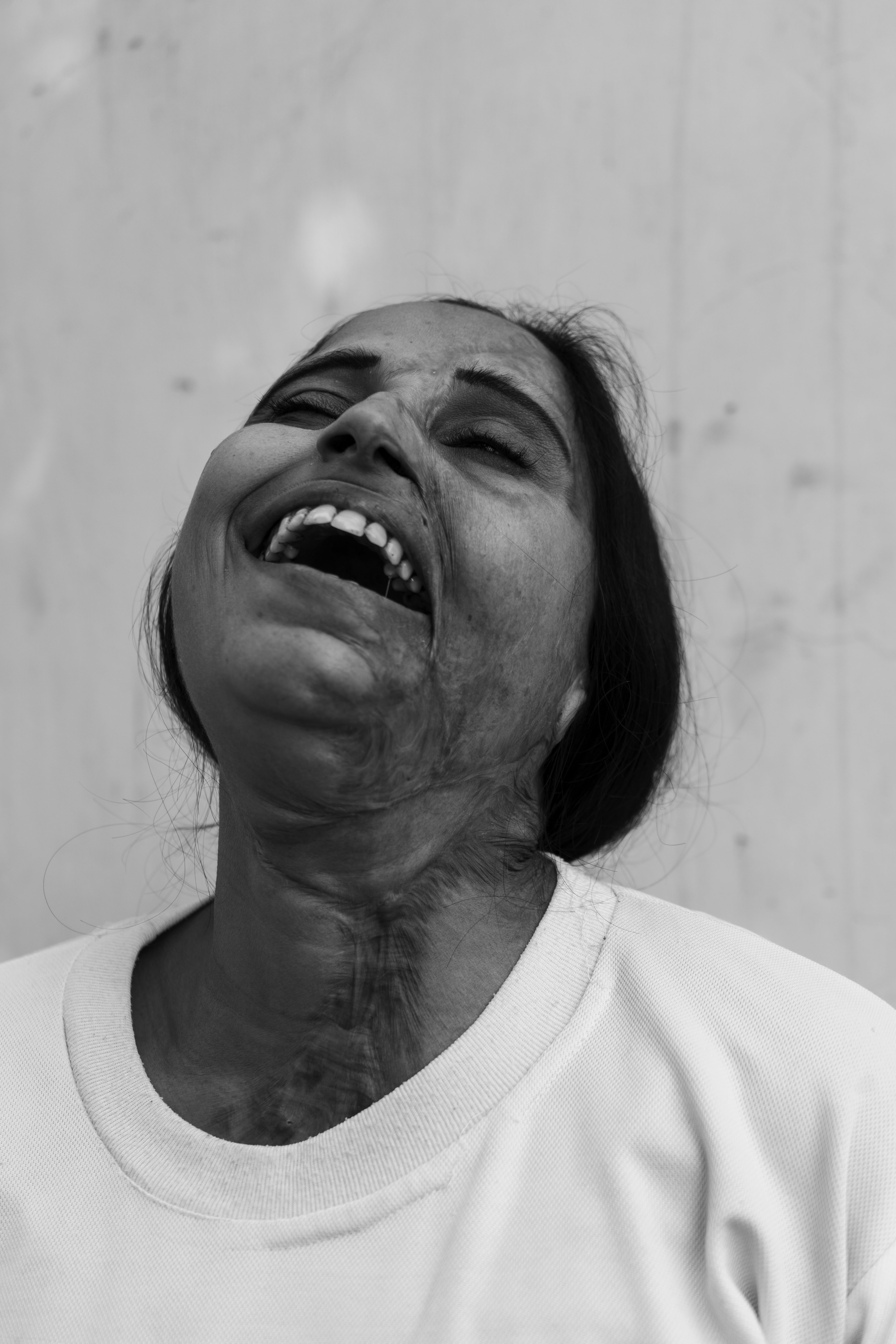 This-Indian-Cafe-is-Run-by-Acid-Attack-Survivors
