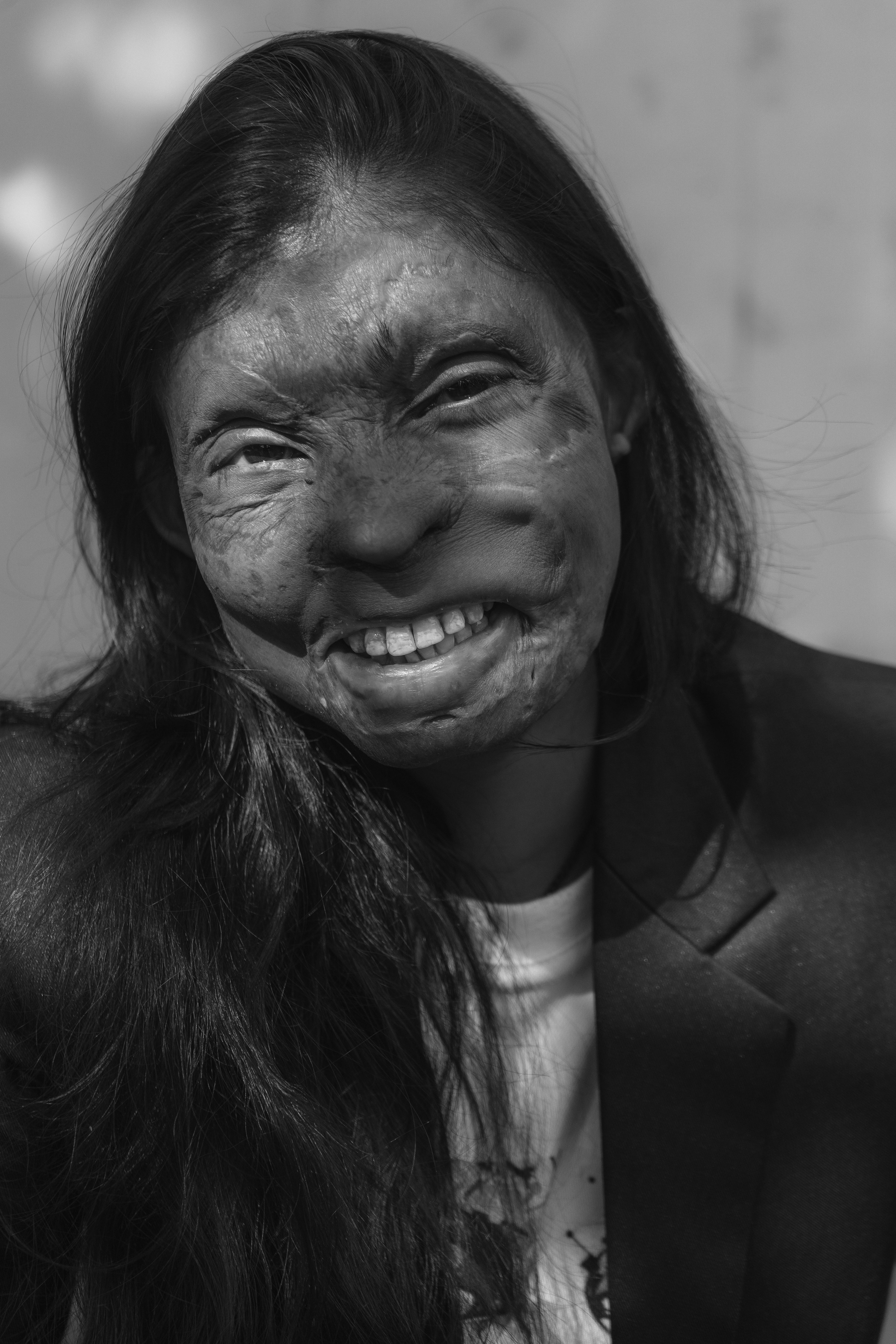 This-Indian-Cafe-is-Run-by-Acid-Attack-Survivors